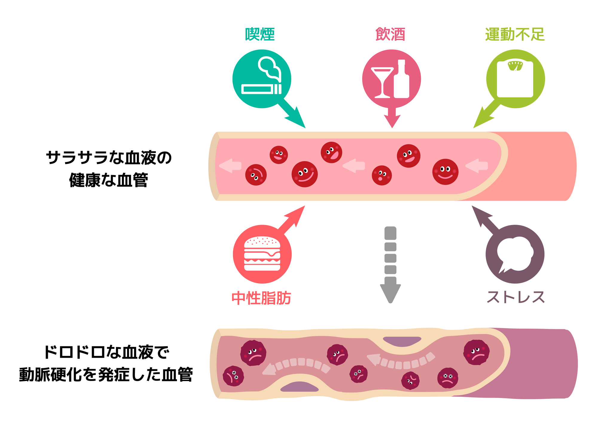 動脈硬化のイメージ画像│足の血管の動脈硬化が進む病気